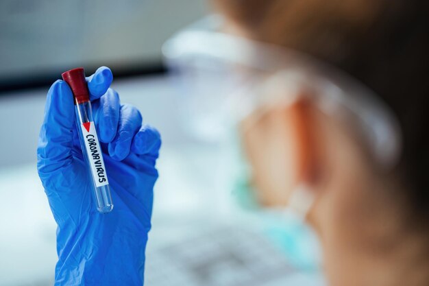 실험실에서 일하는 동안 코로나바이러스가 있는 시험관을 들고 있는 의료 기술자의 근접 촬영