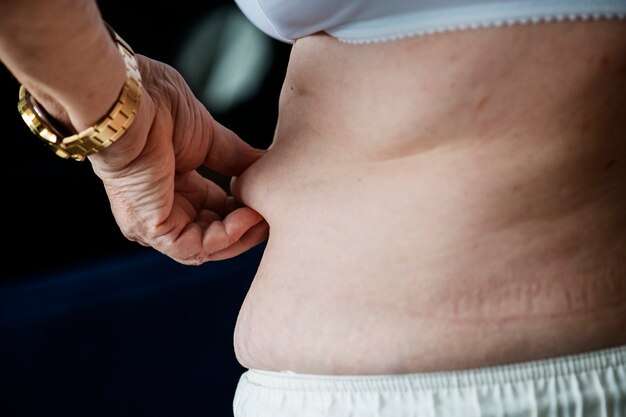 Макрофотография ожирения пожилая женщина