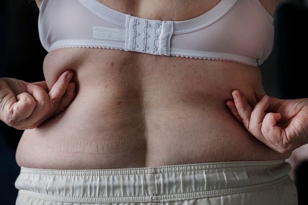 Foto gratuita primo piano di donna anziana obesa