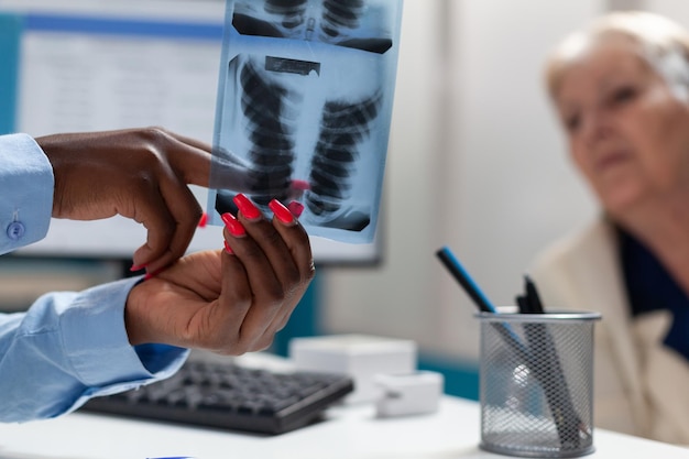 Closeup of therapist doctor holding lungs radiography explaining disease expertise to sick senior disabled woman in wheelchair during medical consultation in hospital office. Medicine concept