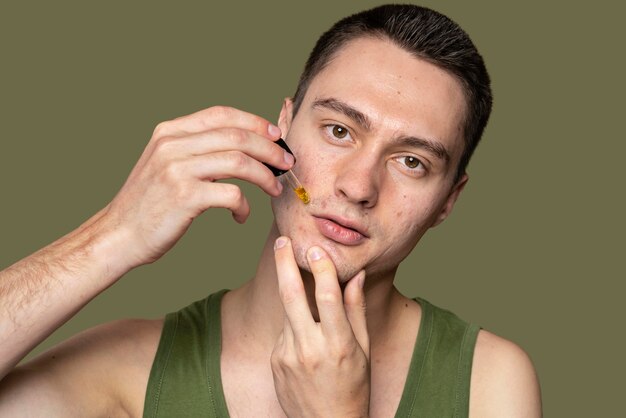 Confident handsome man with acne