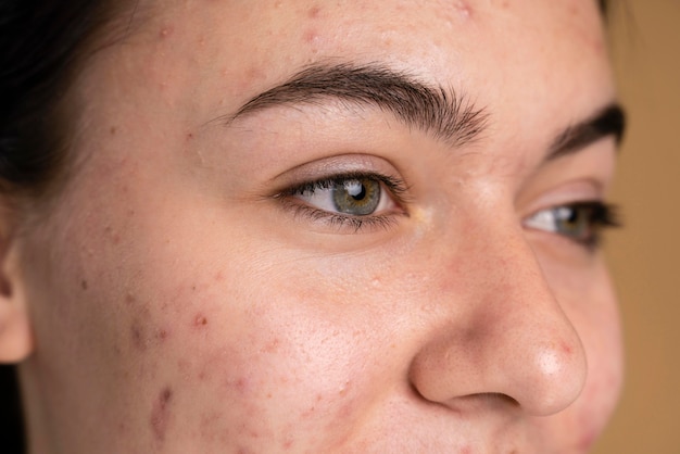 Foto gratuita giovane donna sicura con il primo piano dell'acne