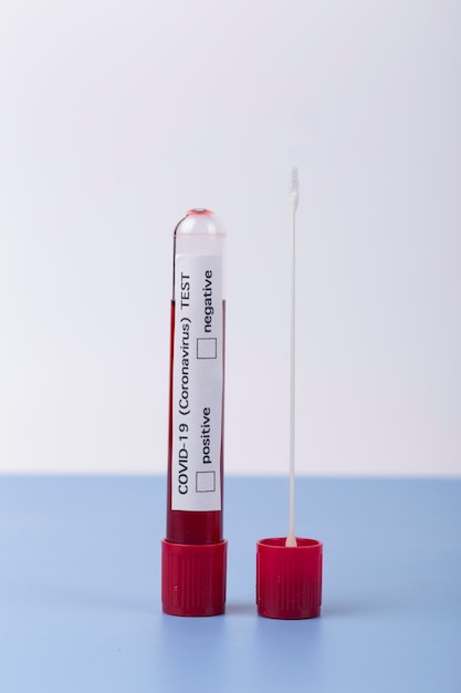 Free photo coronavirus blood sample arrangement in lab