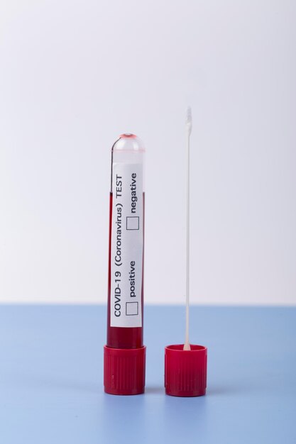 Coronavirus blood sample arrangement in lab