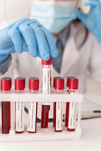 Coronavirus blood samples arrangement in lab