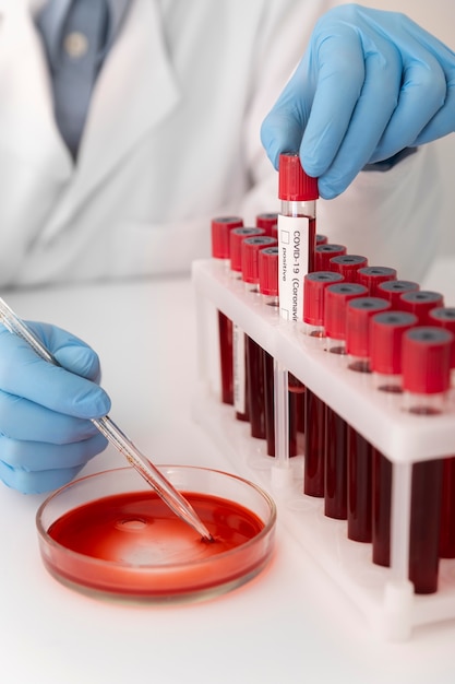 Coronavirus blood samples arrangement in lab