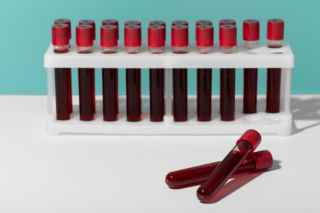 Coronavirus blood samples assortment in lab