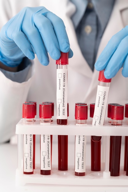 Free photo coronavirus blood samples assortment in lab