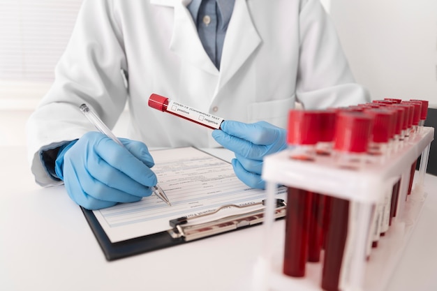 Foto gratuita assortimento di campioni di sangue di coronavirus in laboratorio