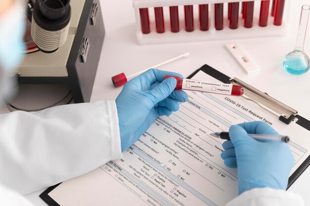 Coronavirus blood samples assortment in lab