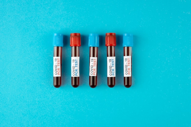 Coronavirus pcr tests arrangement flat lay