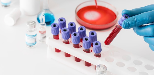 Coronavirus vaccine lab with samples