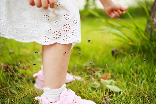 かわいいアジアの少女は、屋外の緑の芝生のフィールドで遊んでいる間、蚊に刺されて足に血を吸うことによる皮膚の発疹とアレルギーを持っています