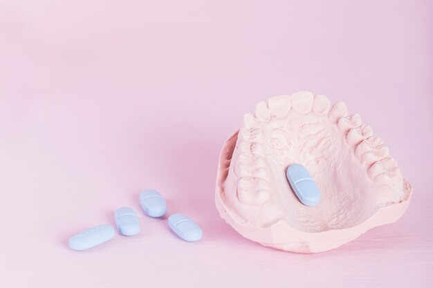 Dental model plaster cast and pills on pink background