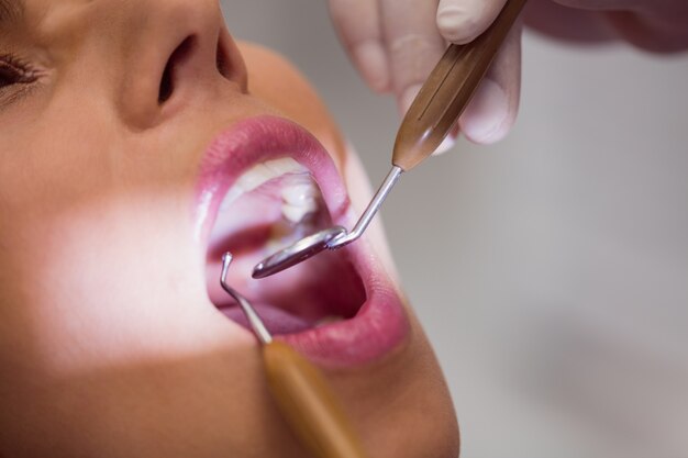 Dentist examining female patient teeth