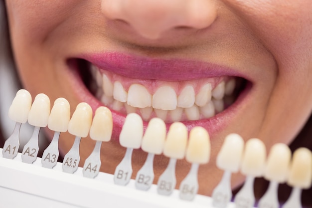 Dentist examining female patient with teeth shades