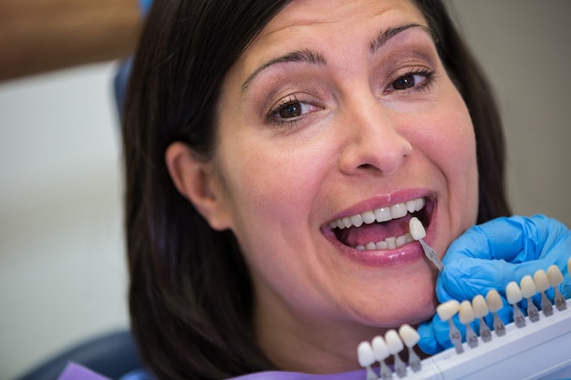 Dentist examining female patient with teeth shades