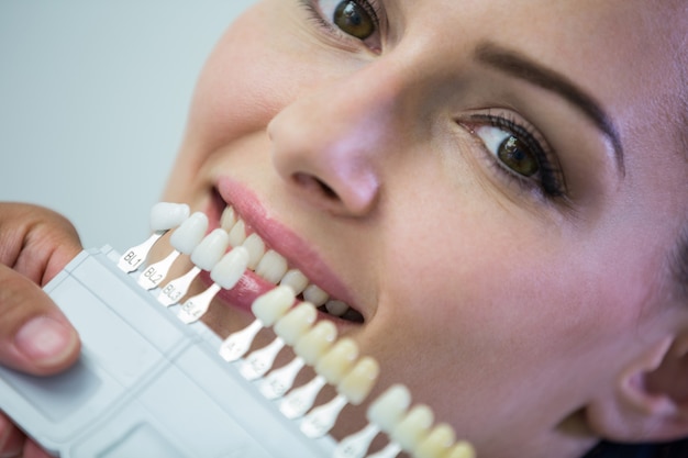 Dentist examining female patient with teeth shades