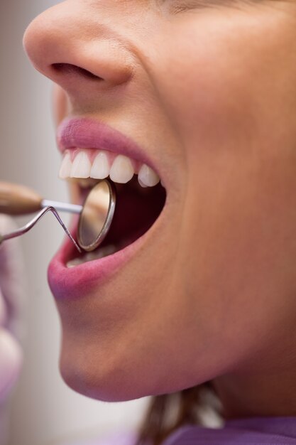 Dentist examining a female patient with tools