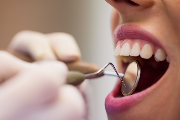 Dentist examining a female patient with tools