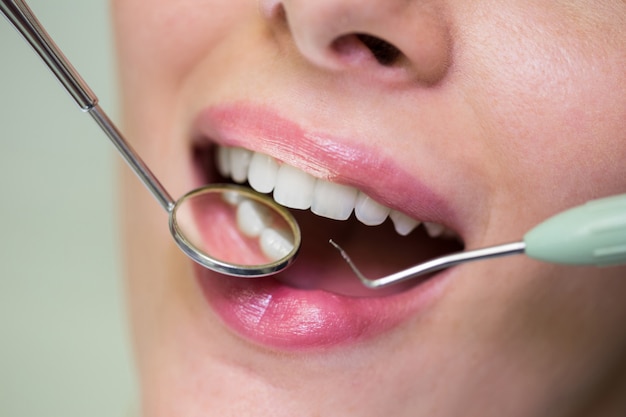 Free photo dentist examining a female patient with tools