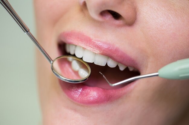 Dentist examining a female patient with tools