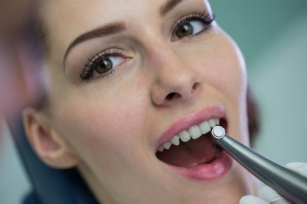 Free photo dentist examining a female patient with tools