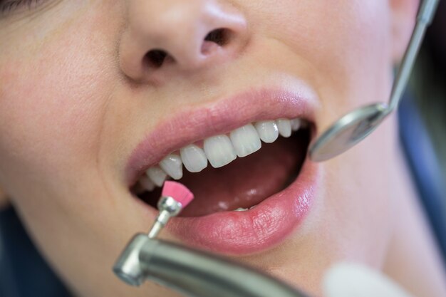 Dentist examining a female patient with tools