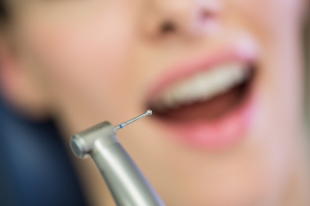 치과 도구로 여성 환자를 검사