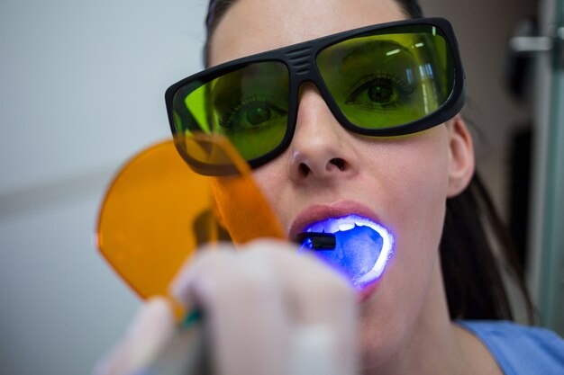 Dentist examining patients teeth with dental curing light