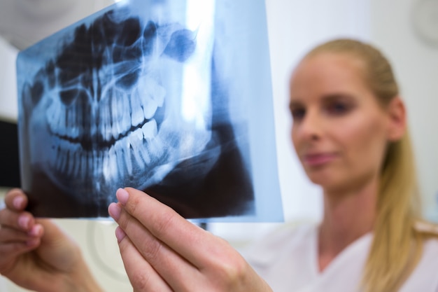 Dentist looking at dental x-ray plate