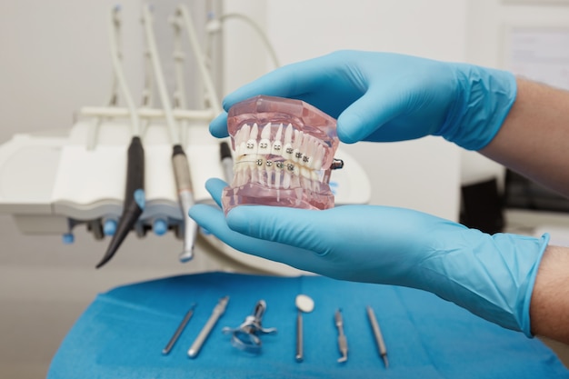 Стоматолог показывает пластиковую модель зубов с подтяжками