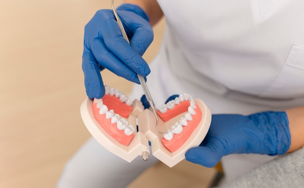 Стоматолог показывает что-то на модели зубов