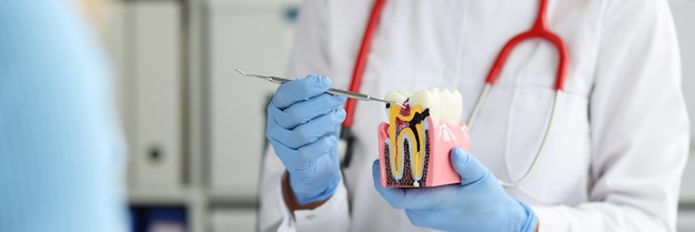 Dentist shows on dental model how caries destroys tooth enamel daily hygiene and dental care