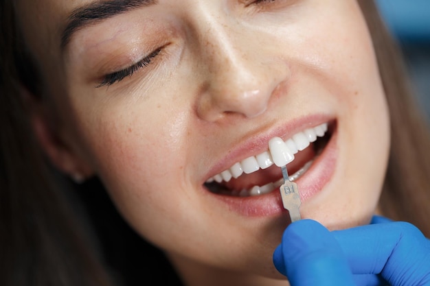 стоматолог белые зубы