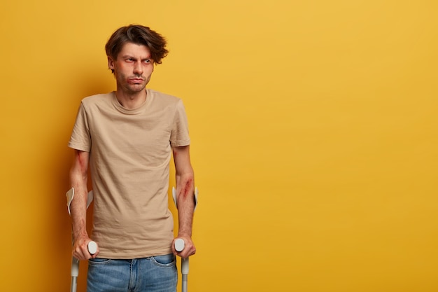 Disabled injured man has broken or sprained ankle, poses with crutches, recovers after dangerous riding on bike, needs surgery, has bruised face and arms, isolated on yellow wall, blank space