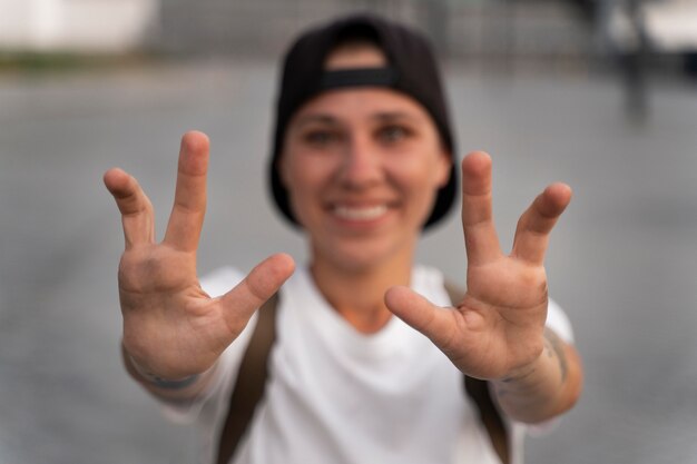 Disabled person with oligodactyly hands