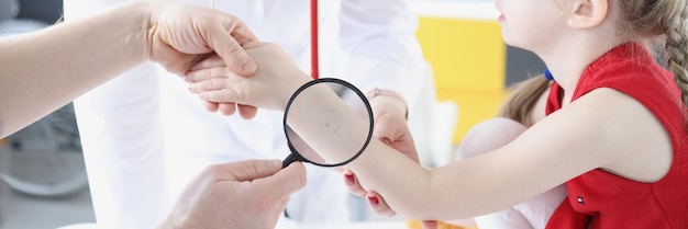 Doctor examining baby skin on hand with magnifying glass in clinic treatment of pigmented nevi