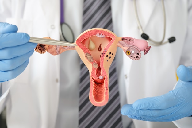 Doctor holding dummy of uterus with ovaries to university closeup. medical education gynecology concept