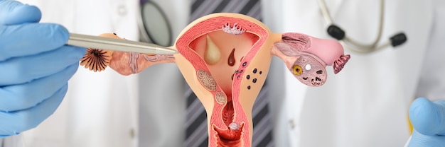 Doctor holding dummy of uterus with ovaries to university closeup