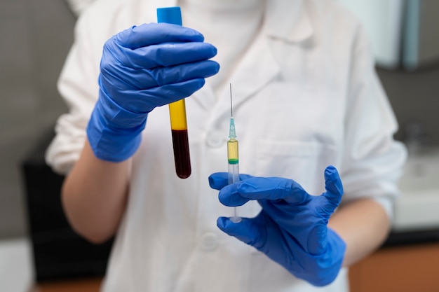 Doctor holding syringe and prp vial