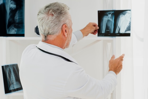 Free photo doctor holding x-ray against light