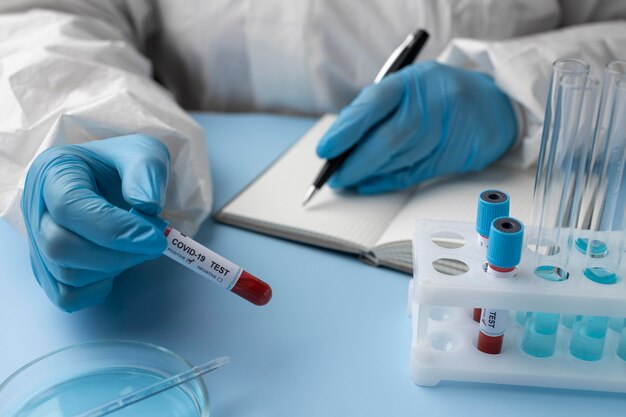 Doctor with blood samples making a medical report