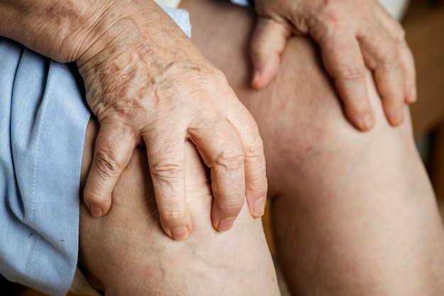 Free photo elderly woman suffering knee pain