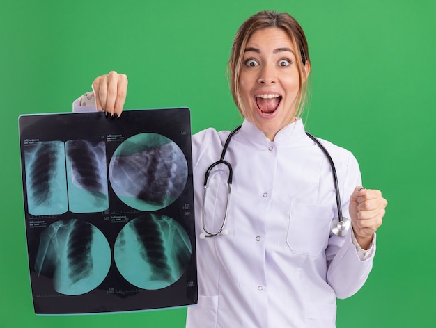 Возбужденная молодая женщина-врач в медицинском халате со стетоскопом держит рентгеновский снимок, показывающий жест да, изолированный на зеленой стене