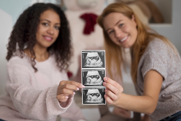 Family of two mums having a baby