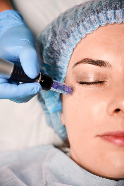 Female client having fractional mesotherapy in beauty salon