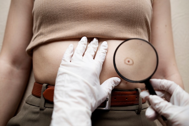 Бесплатное фото Женщина-врач диагностирует меланому на теле пациентки