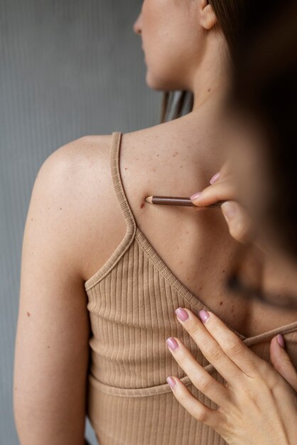 female doctor diagnosing a melanoma on the body of a female patient
