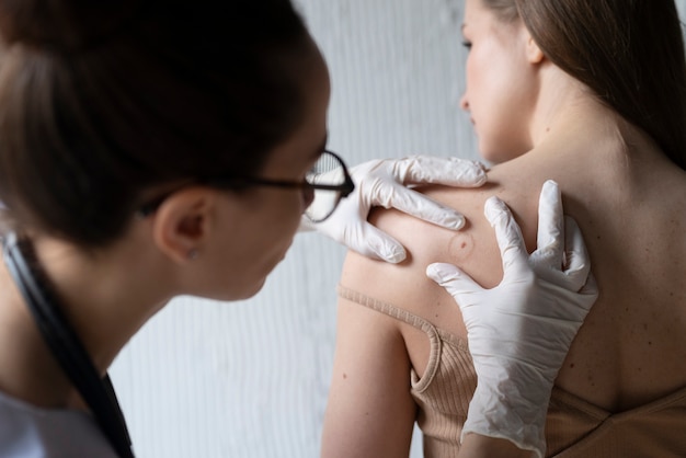 Female doctor diagnosing a melanoma on the body of a female patient